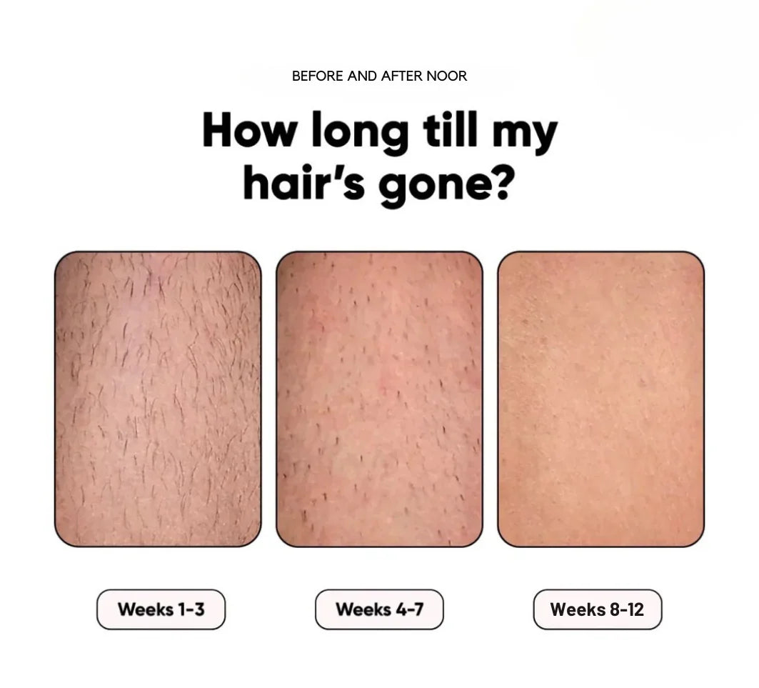 GlowSilk IPL Hair Removal Handset – Smooth Skin at Home